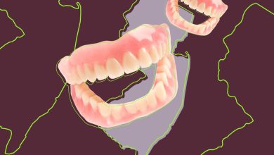 كيف وضع احتكار الأسنان الاصطناعية دعوى مكافحة الاحتكار التي قدمتها وزارة العدل لشركة أبل في نيوجيرسي