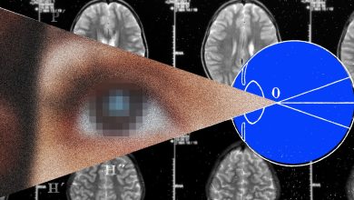 الحدود التالية لزراعة الدماغ هي الرؤية الاصطناعية