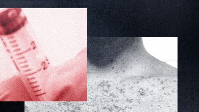 مضادات الفاكسين تنحرف عن اندلاع الحصبة-ويدعي أن سلاحًا حيويًا تسبب فيه